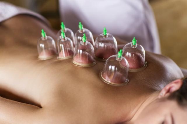 Cupping therapy La Valette-du-Var Cupping therapy La Valette-du-Var